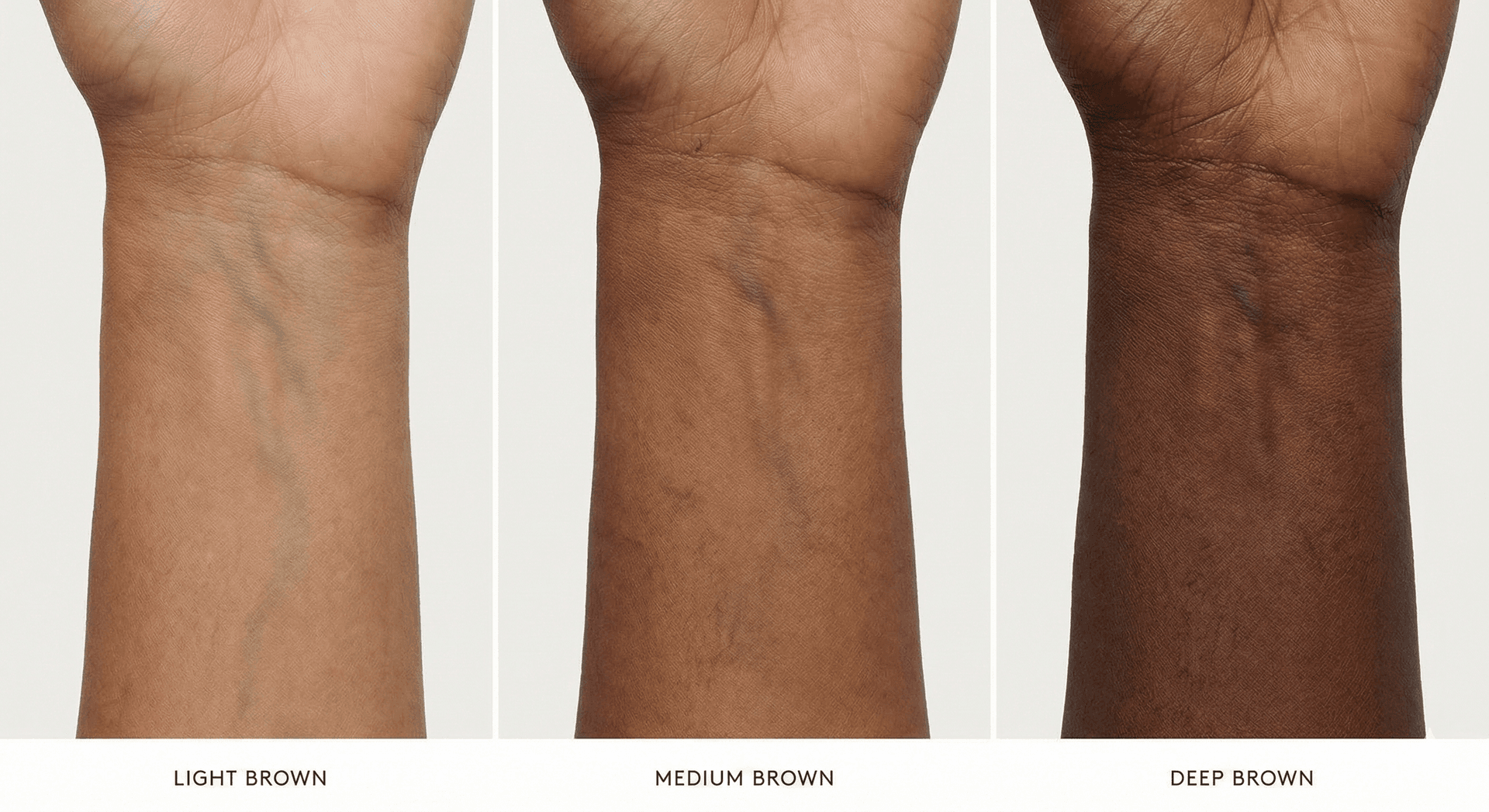 Diagram showing what vein appearance actually indicates vs what it doesn't